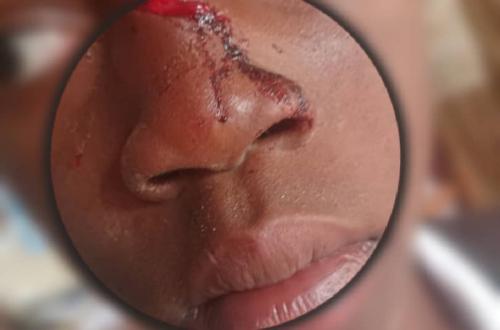 Bukavu : Une sentinelle blesse un élève avec une machette à l'école primaire de Bulenga dans la commune de Bagira