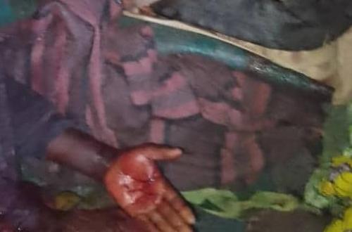 Un mort et des blessés lors d’une attaque au site de déplacé