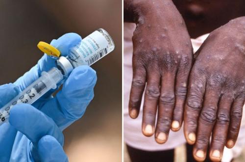 Plus de 500 000 personnes vaccinées contre le Mpox